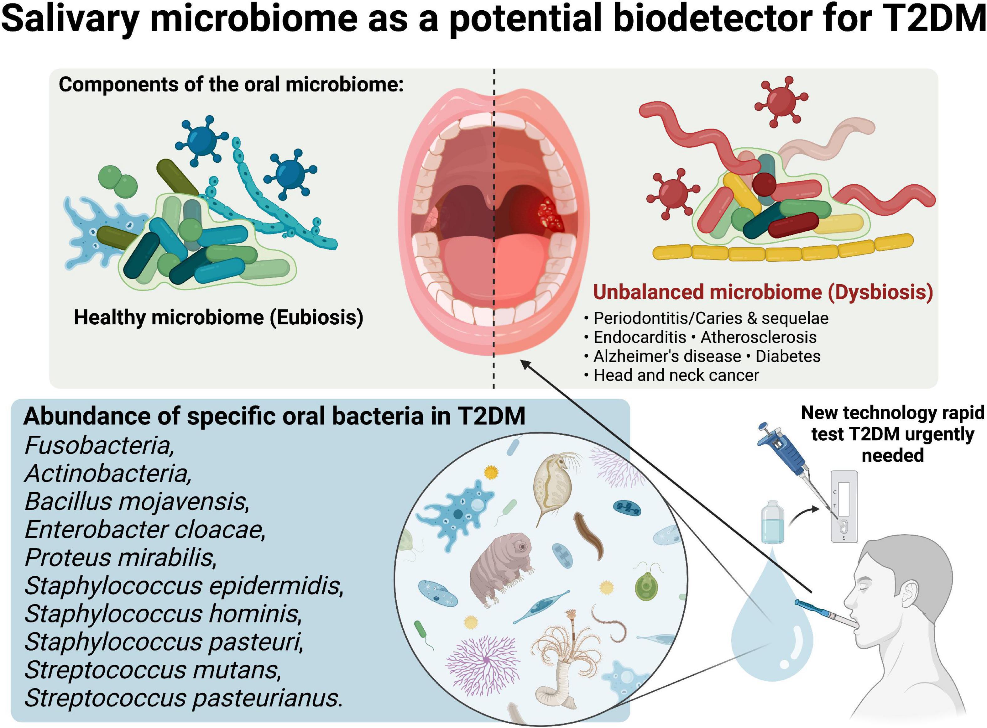 Can salivary microbiome become a biodetector for type-2 diabetes? Opinion for future implications and strategies